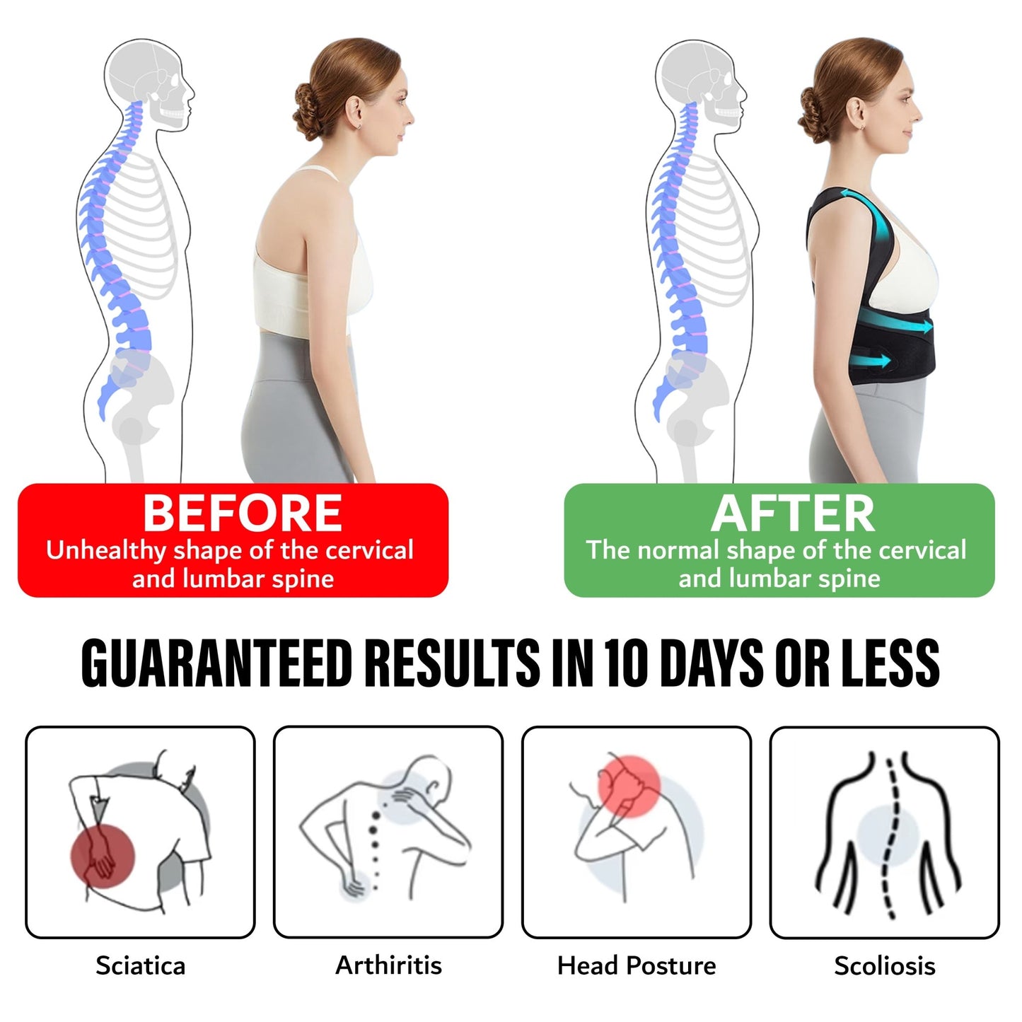 UpRight™ Posture Corrector